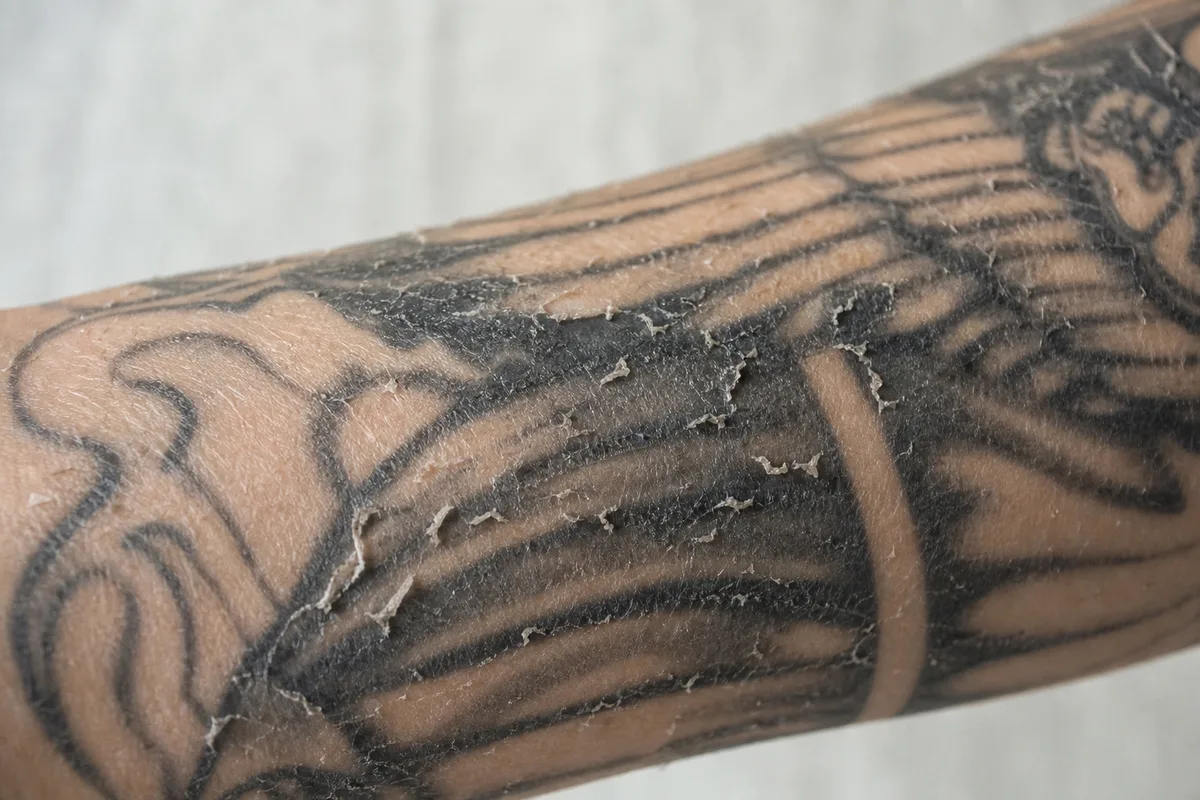 Gros plan sur un avant-bras tatoué en cours de desquamation, fines peaux qui pèlent sur un motif à l’encre noire
